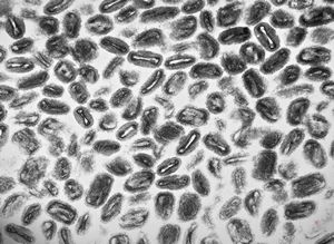 F, 7y. | molluscum contagiosum … virions F, 7y. | molluscum contagiosum … virions